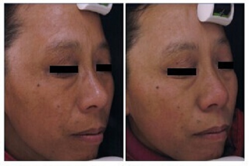 1650607821117331.jpg 1458870677.jpg